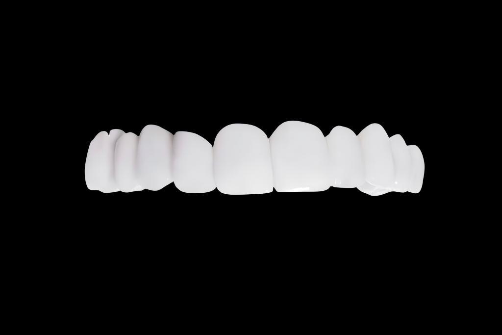 Orthodontic Appliances}