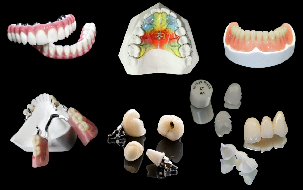 Fixed dental restoration from SKY Dental Lab